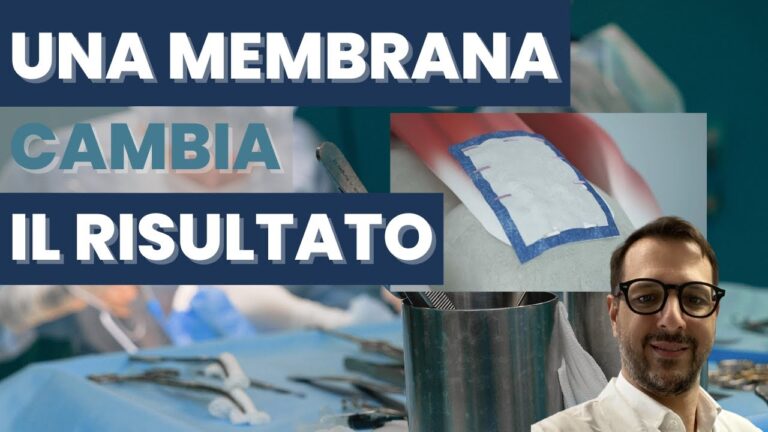 Come trattare lesioni ai tendini della spalla: guida completa