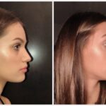5 efficaci rimedi per il naso tappato
