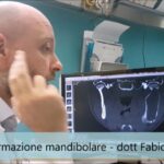 Peperoni in Padella con Cipolla e Pomodoro: Un Piatto Saporito e Facile