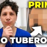 Guida alla Posologia Ottimizzata delle Gocce di Contramal