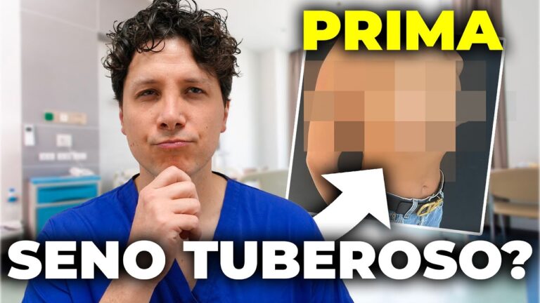 Seno Tuberoso Rifatto: Approcci e Risultati