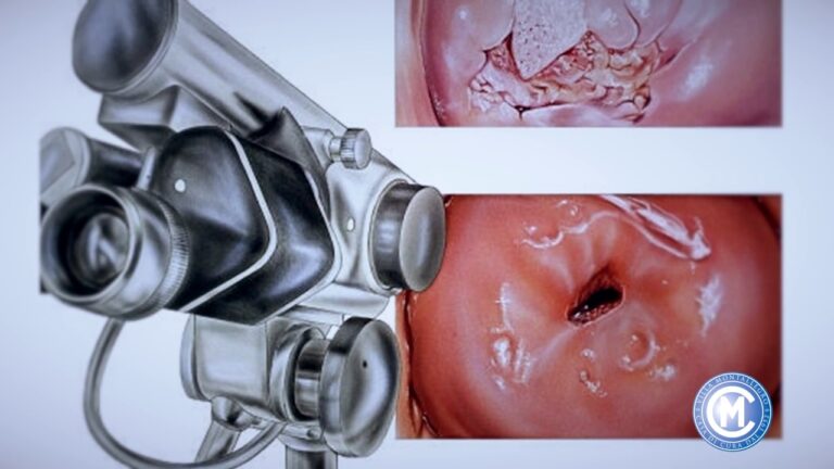 Costo Pap Test: Risparmia sul Tuo Esame Ginecologico