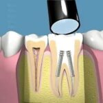 Imparare dagli Errori: La Massima che Valorizza l’Esperienza