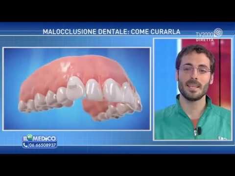 Importanza dell’Occlusione Dentale Corretta