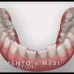 Riconoscere la Premenopausa: Segnali e Sintomi da Tenere d’Occhio