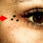 Debridat 150 mg: scopri il prezzo vantaggioso per contrastare il mal di stomaco!