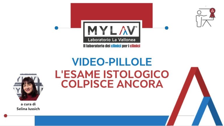 Risultati esame istologico dopo un mese