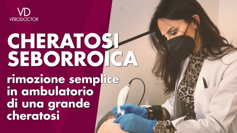 Come eliminare cheratosi in modo naturale: 5 metodi efficaci