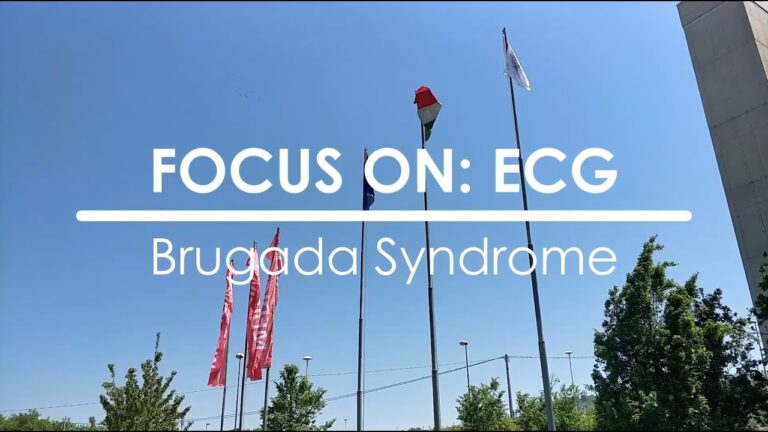 La guida definitiva all’ECG Punto J