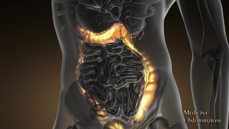 Il Miglior Probiotico per i Diverticoli: Guida alla Scelta Optimal