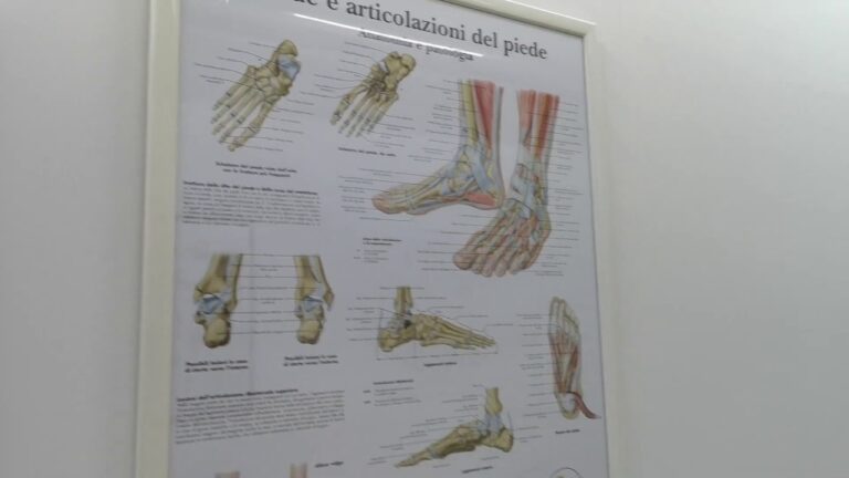 Sanitaria ortopedia vicino a me: Guida completa