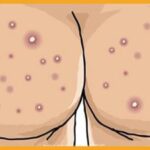 Advantix: Effetti Collaterali Sconvolgenti? Scopri Cosa Fare!