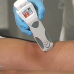 Scopri il sorprendente test di Amsler positivo: la chiave per la tua salute visiva!
