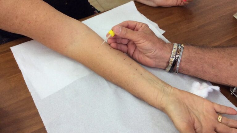 Come fare le prove allergiche: guida completa