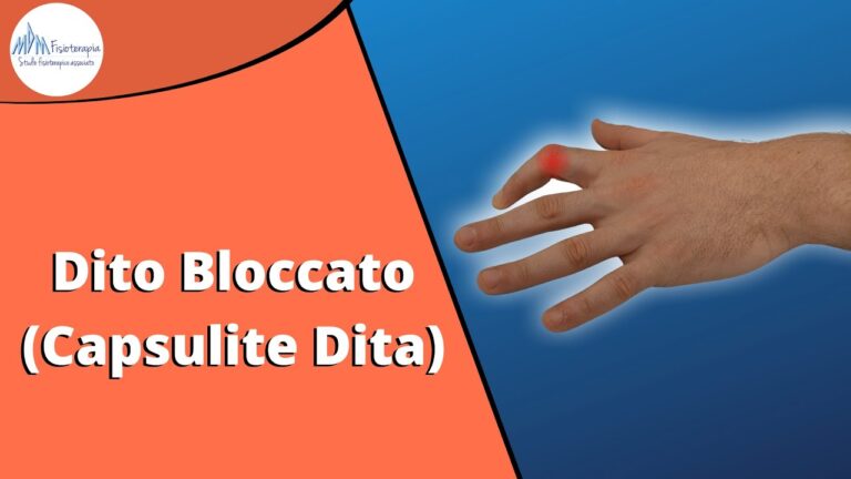 Contusione al Dito della Mano: Cause, Sintomi e Trattamento
