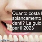 Sindrome di Sjögren e Salute Dentale