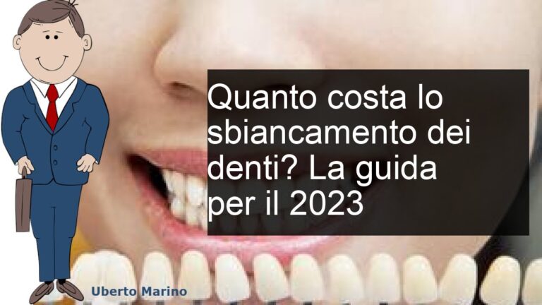 Costo sbiancamento dentale: quanto spendere per un sorriso perfetto