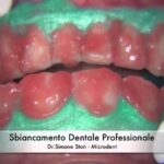 Come ottenere denti bianchi in soli 2 minuti