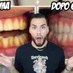 Come gestire la febbre da dentizione nel neonato