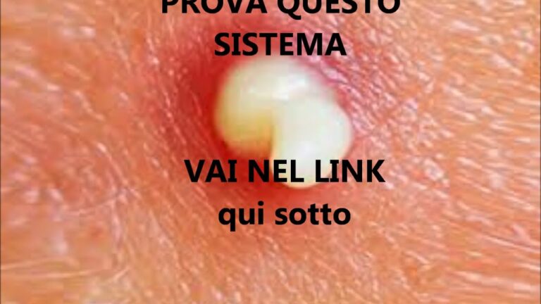 Come trattare i brufoli sulle grandi labbra