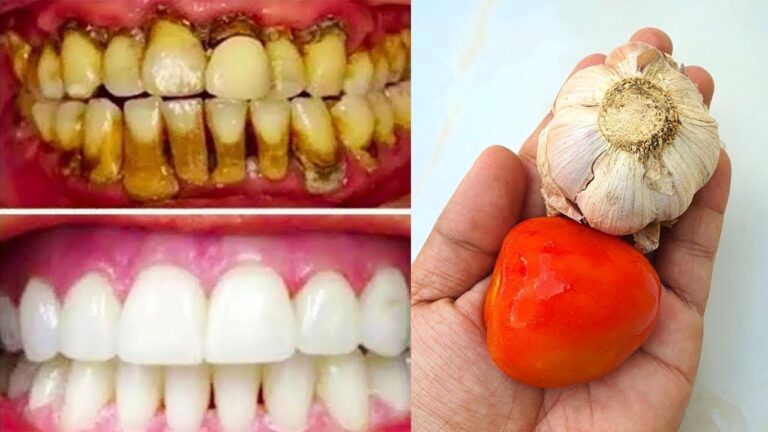 Come ottenere denti bianchi in soli 2 minuti