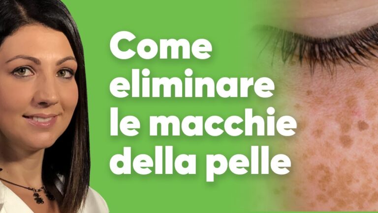 Come eliminare le macchie dalla pelle del viso