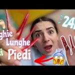 Macchie Marroni sul Glande: Cause e Rimedi