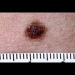 Aircort Spray Nasale 50 mg: il prezzo che sbalordir&agrave;!