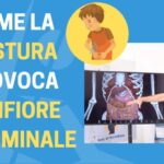 Lassativi Forti: Efficacia e Rischi da Conoscere