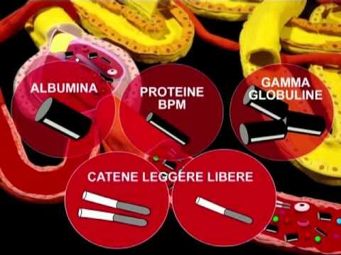 Livelli di Albumina nelle Urine: 30 mg/dl
