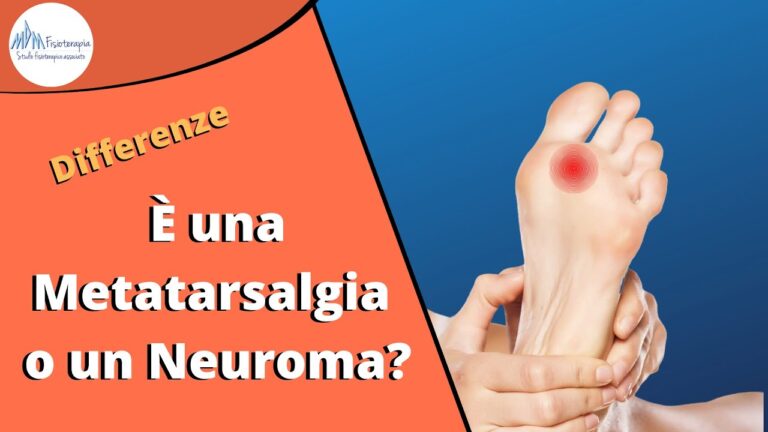 Come trattare efficacemente il neuroma di Morton non curato