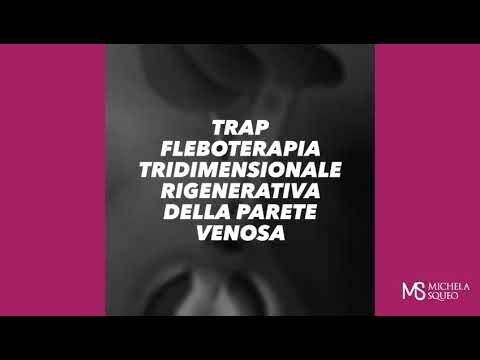 Bologna Trap: L’Essenza del Suono Veneziano