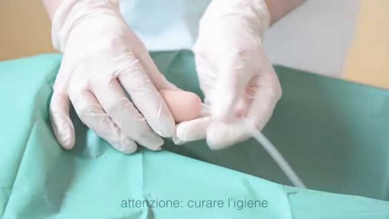 Gestione del catetere vescicale a casa