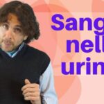 Quando piantare l’avocado per la fruttificazione