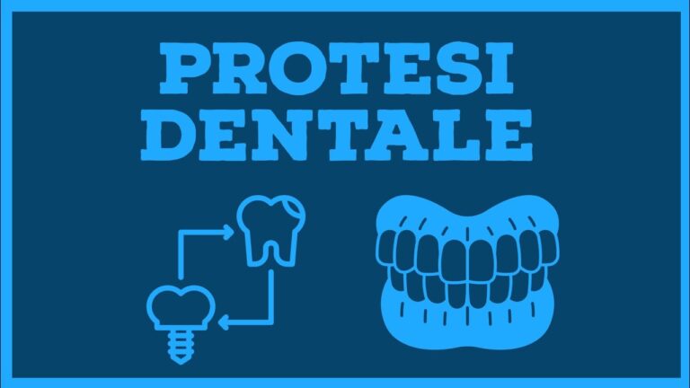 Costo impianto dentale con mutua