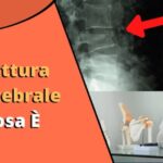 Quanto dura la pericoronite del dente del giudizio