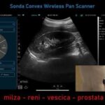 Benefici della Carnitina e B12 per Anziani