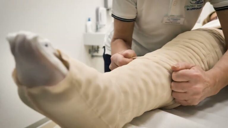 Centri specializzati nel trattamento del lipedema: una guida completa