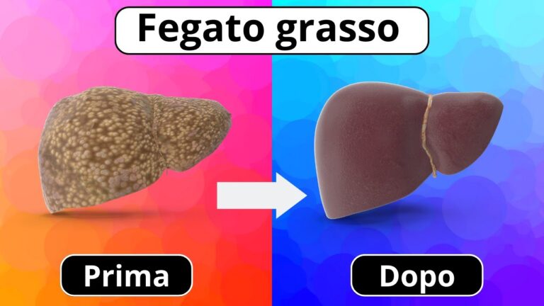 Dieta per ridurre il grasso al fegato