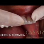 Milesax compresse: la soluzione rivoluzionaria per il benessere fisico in sole 70 caratteri!