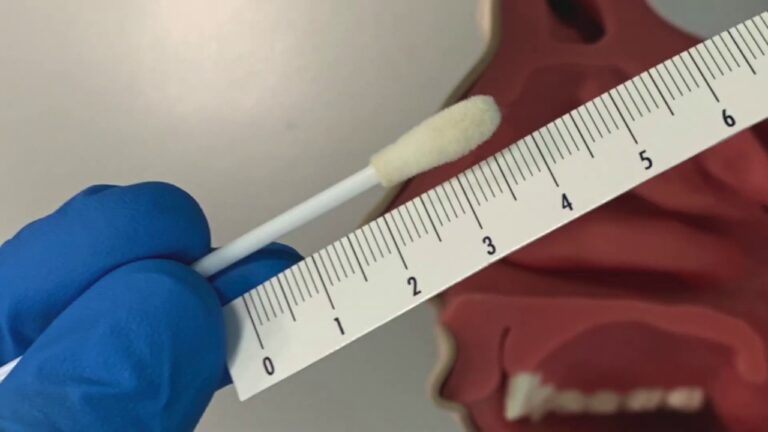 Guida per gestire la perdita di sangue dal naso durante il COVID