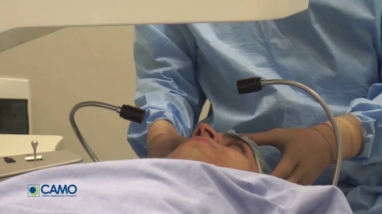 Rischi dell’operazione laser agli occhi: cosa sapere