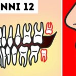Come ottenere denti bianchi in soli 2 minuti