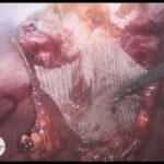 Prezzo Holter Cardiaco: Guida ai Costi e Vantaggi