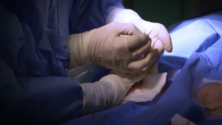 Si Può Dormire Sul Lato Del Pacemaker