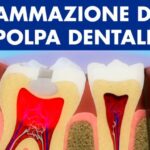 Come ottenere denti bianchi in soli 2 minuti
