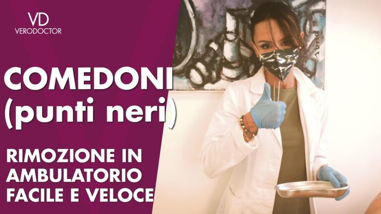 Come eliminare i punti neri grossi: 5 metodi efficaci