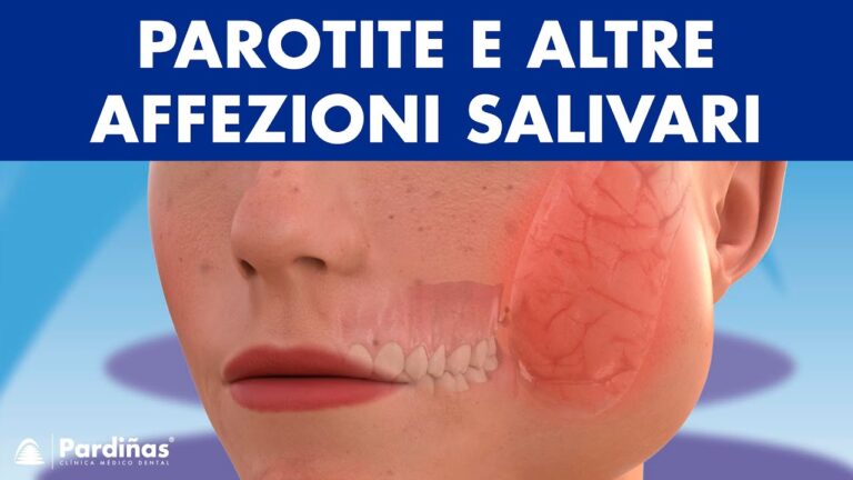 Mucocele sotto la lingua: cause e trattamento