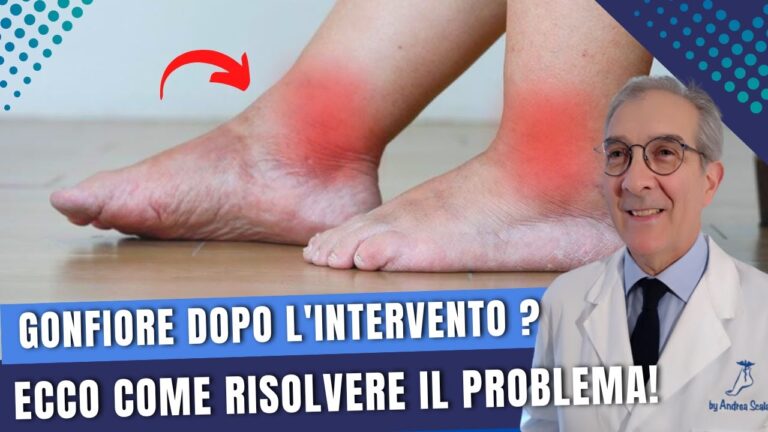 Come trattare il gonfiore e il calore al dorso del piede