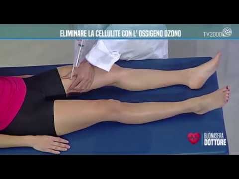 Ozonoterapia: Prima e Dopo